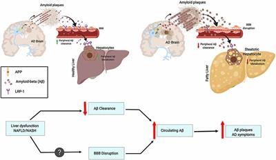 Liver Dysfunction as a Novel Player in Alzheimer’s Progression: Looking Outside the Brain